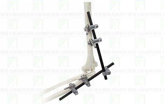 carbon-fiber-rods-ortho (1).jpg carbon-fiber-rods-ortho (1).jpg